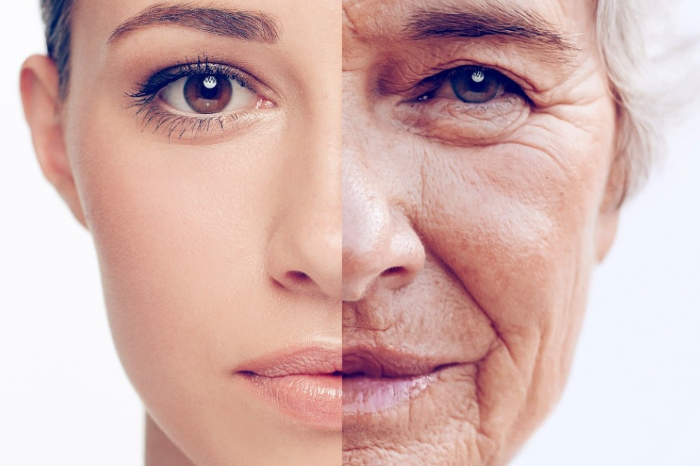 Anti-Aging